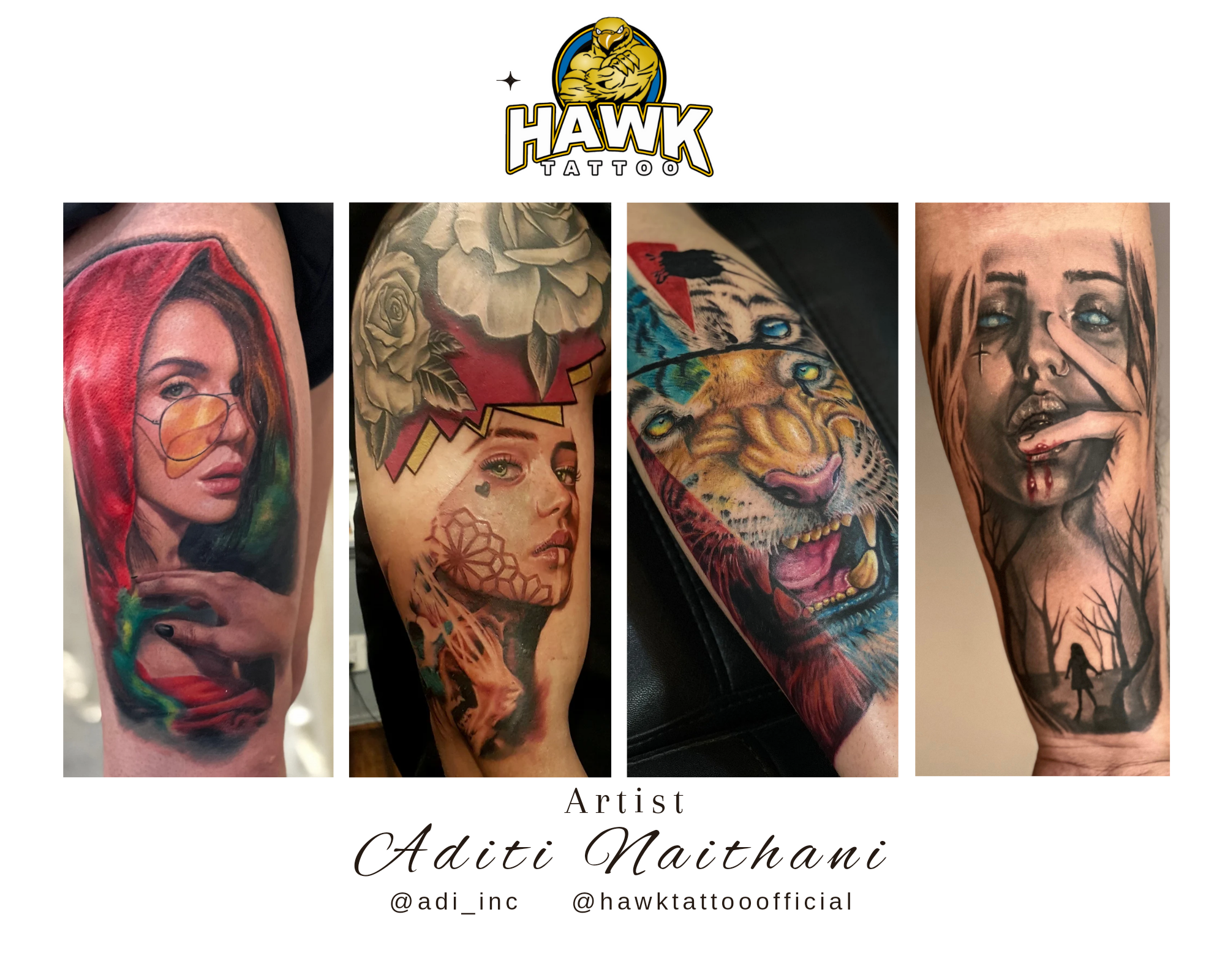 Tattoo Removal | Advanced Laser Clinic Cairns